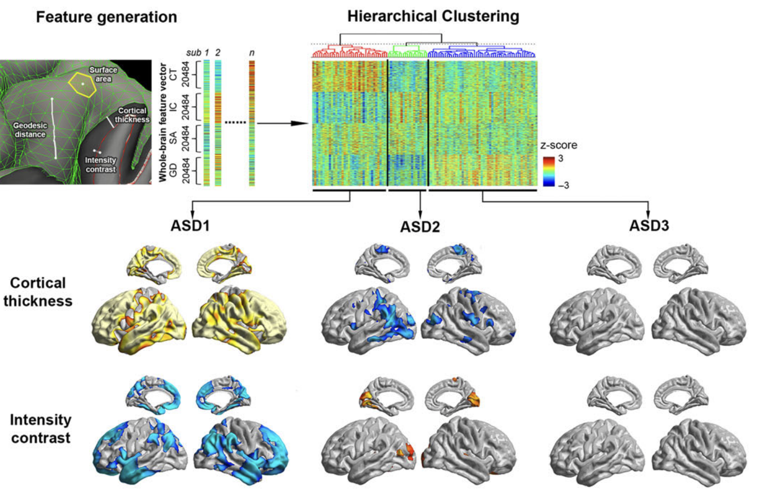 Multidimensional neuroanatomical subtyping of autism spectrum disorder