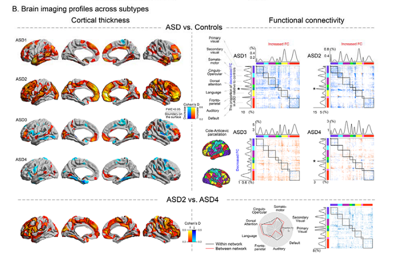 A convergent structure-function substrate of cognitive imbalances in autism